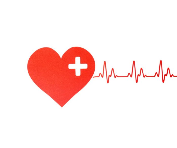 Exercise 31 conduction system of the heart and electrocardiography