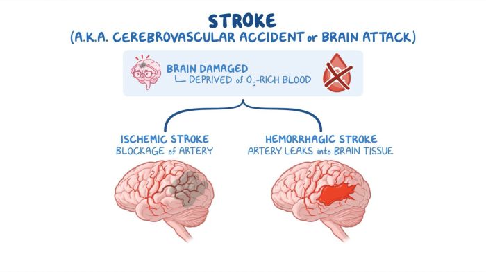 Nursing care complex intracranial and neurologic alterations